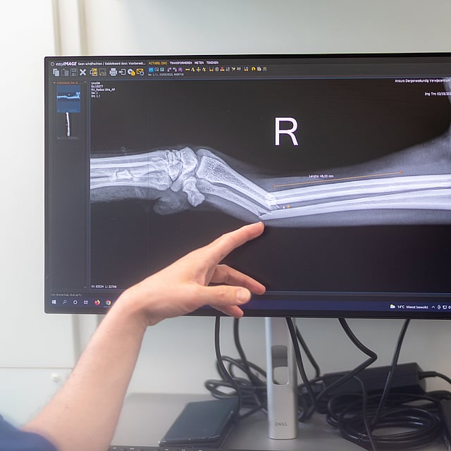 Een persoon die naar een computerscherm wijst.
