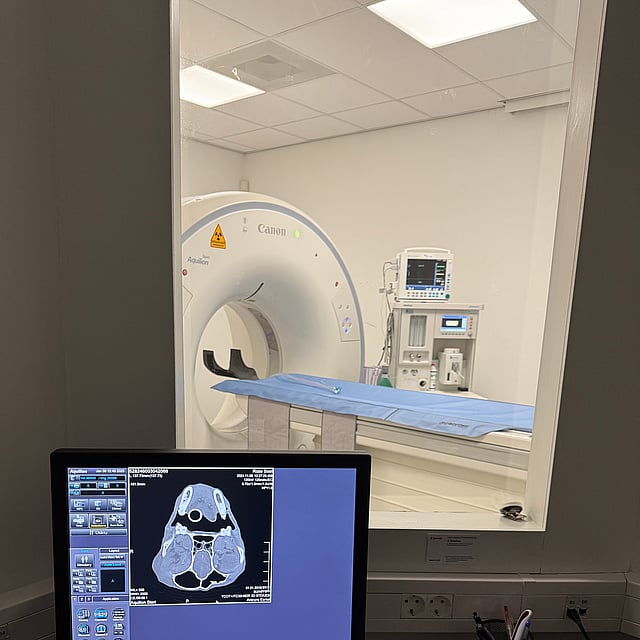 Een computerscherm met op de achtergrond een CT-scan.