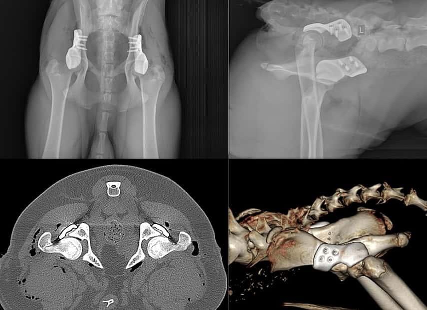 3D HIP