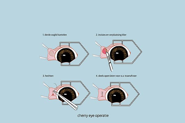 Een diagram van een menselijk oog.