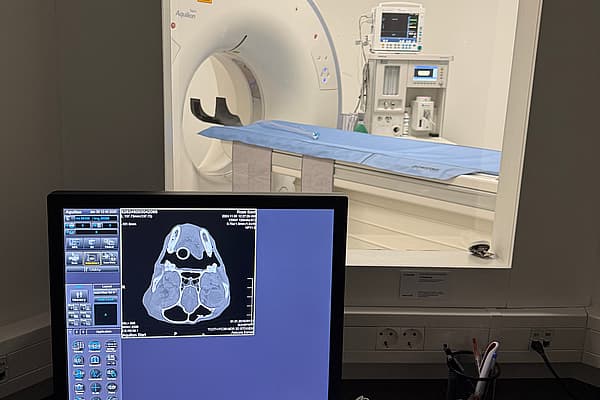 Een computerscherm met op de achtergrond een CT-scan.