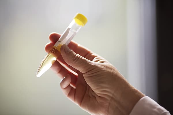 Een hand die een buis met een gele dop vasthoudt.