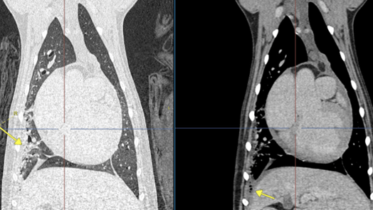Een close-up van een MRI.