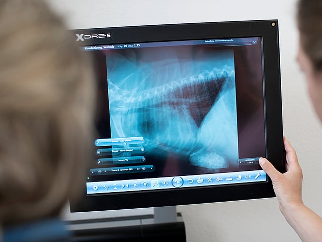 Een persoon die een röntgenfoto bekijkt.