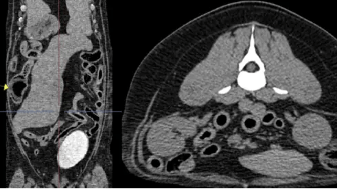 Een close-up van een CT-scan.