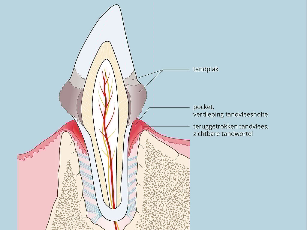 Een diagram van een tand.