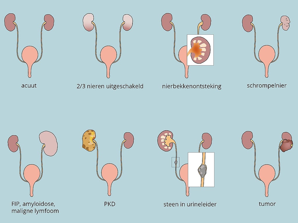 Een diagram van verschillende soorten urinewegen.