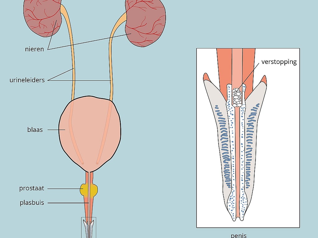 Diagram van een diagram van een menselijk lichaam.