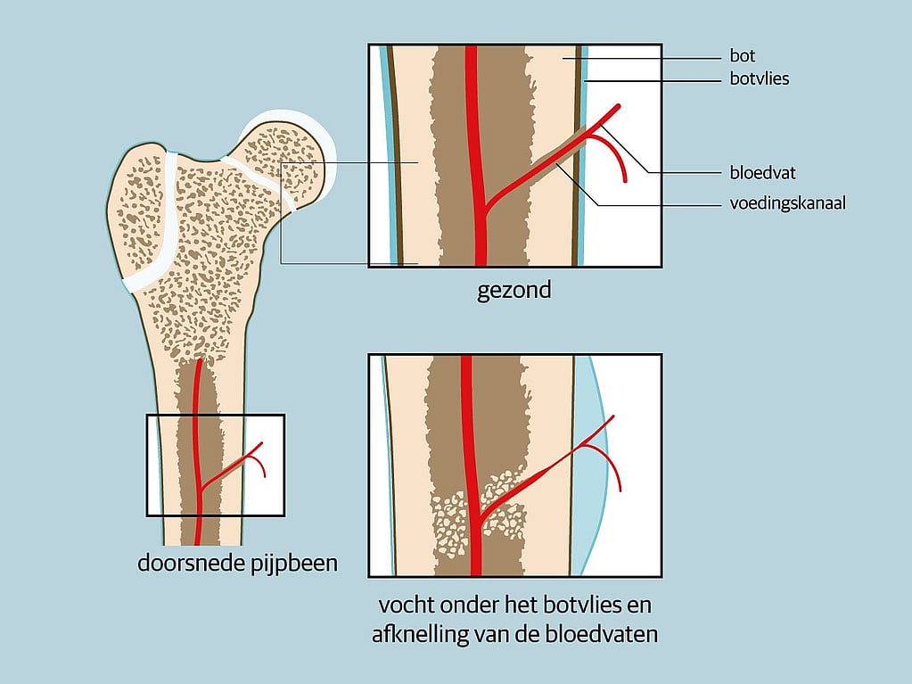 Een diagram van een bot.