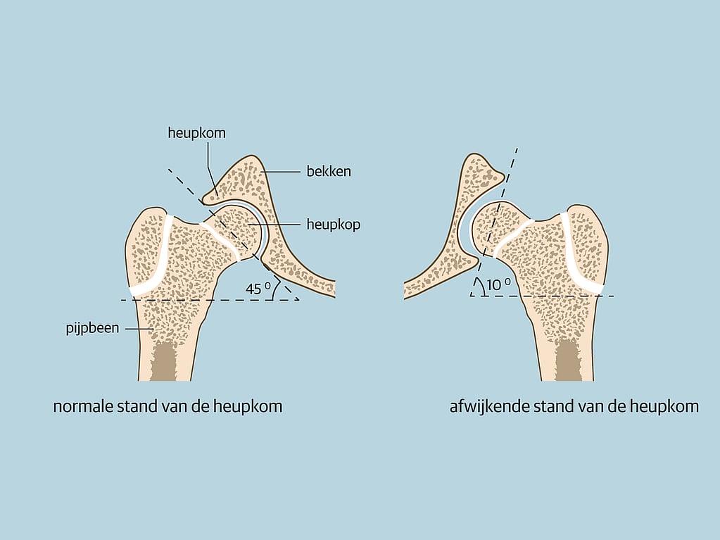Een diagram van botten en gewrichten.