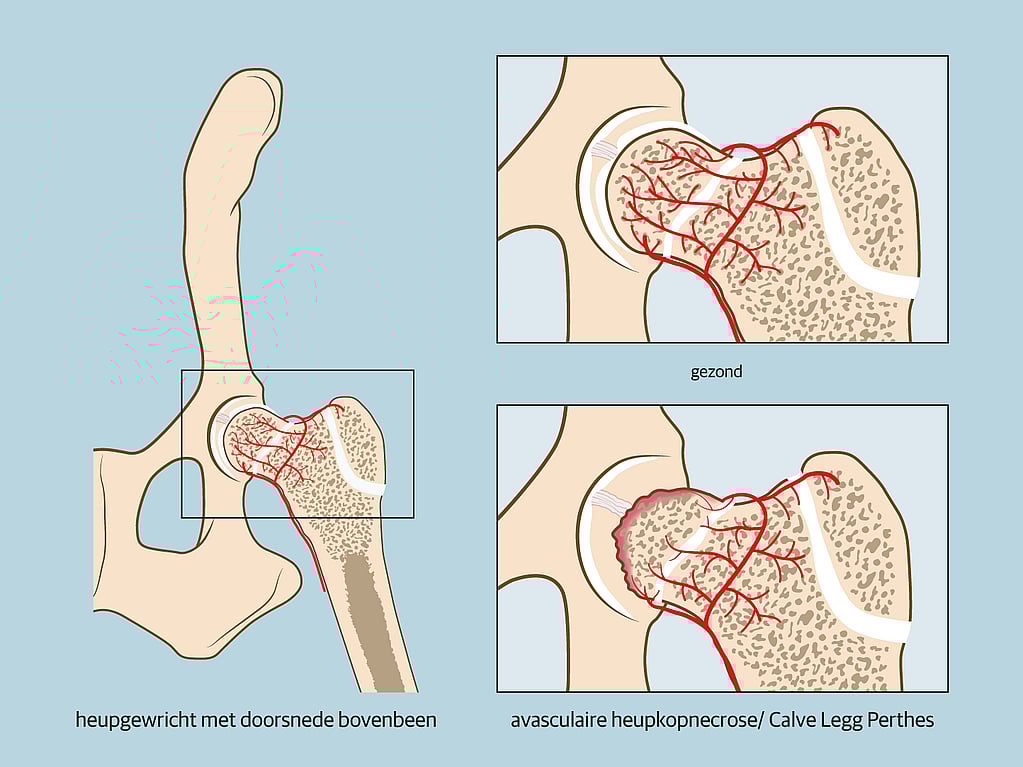 Een diagram van een bot.