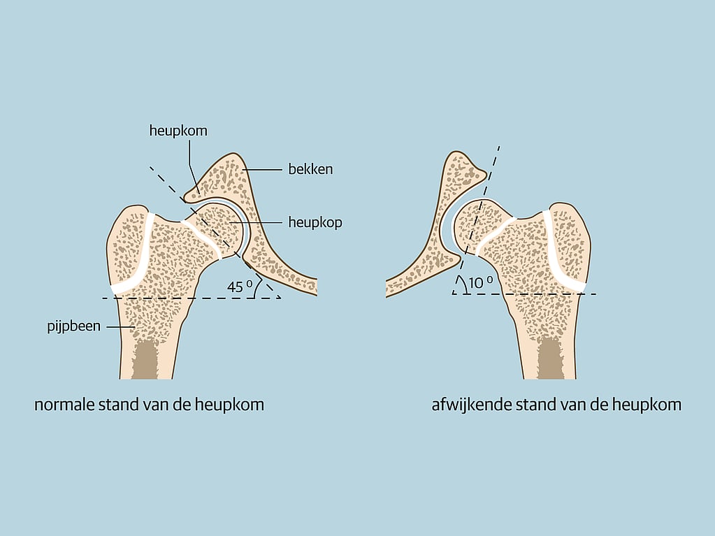 Een diagram van botten en gewrichten.