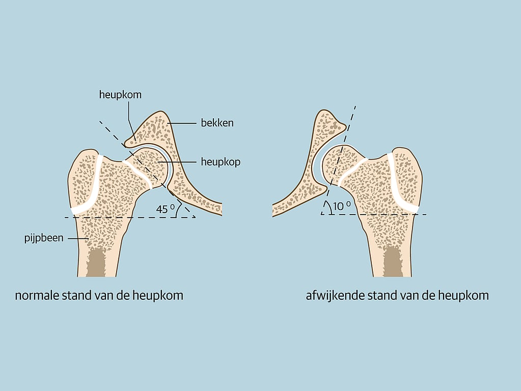 Een diagram van botten en gewrichten.