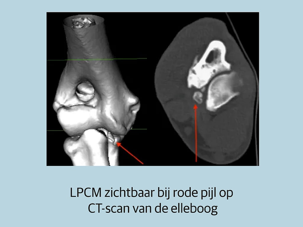 Een close-up van een röntgenfoto.