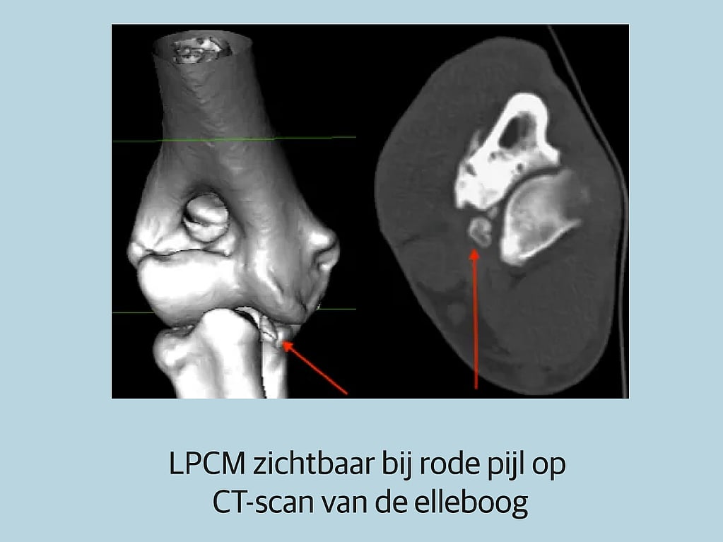 Een close-up van een röntgenfoto.