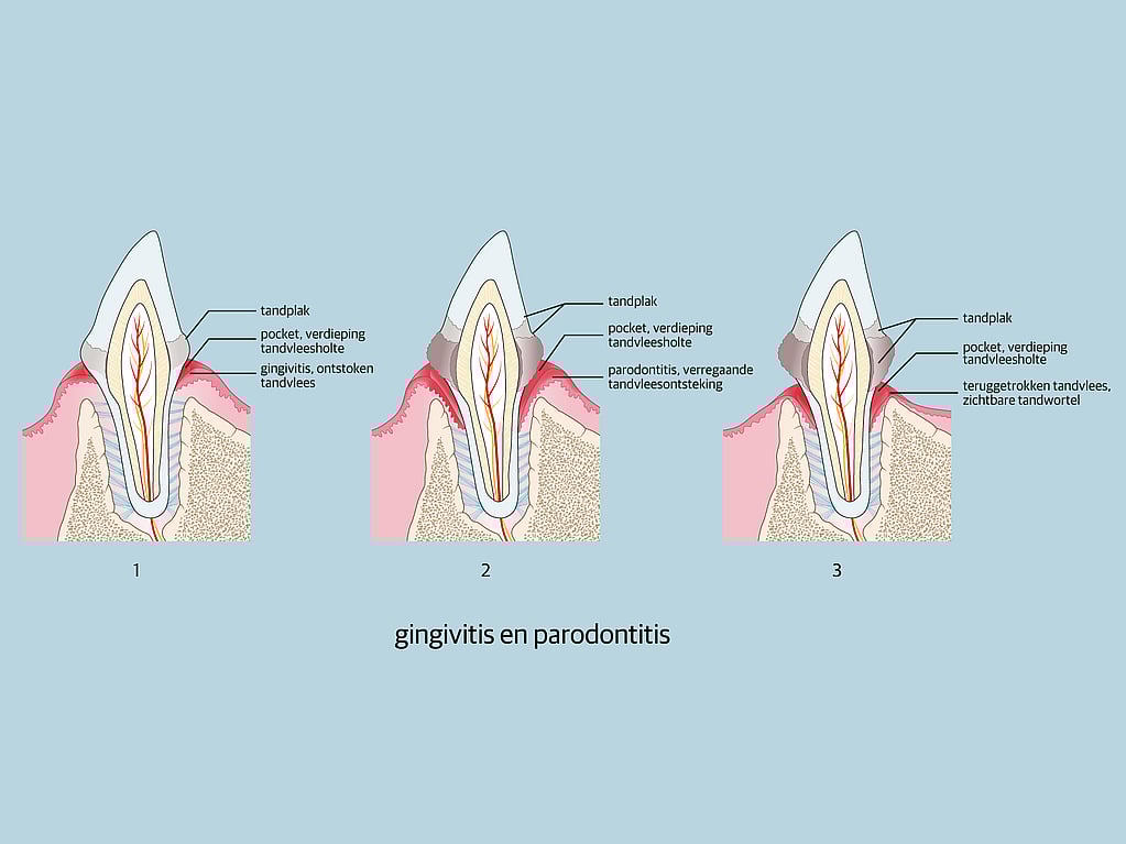 Een diagram van tanden met verschillende soorten tanden.