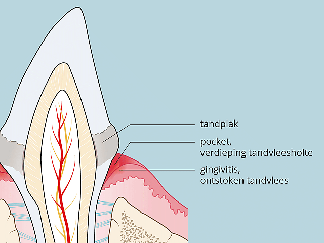 Een diagram van een tand.