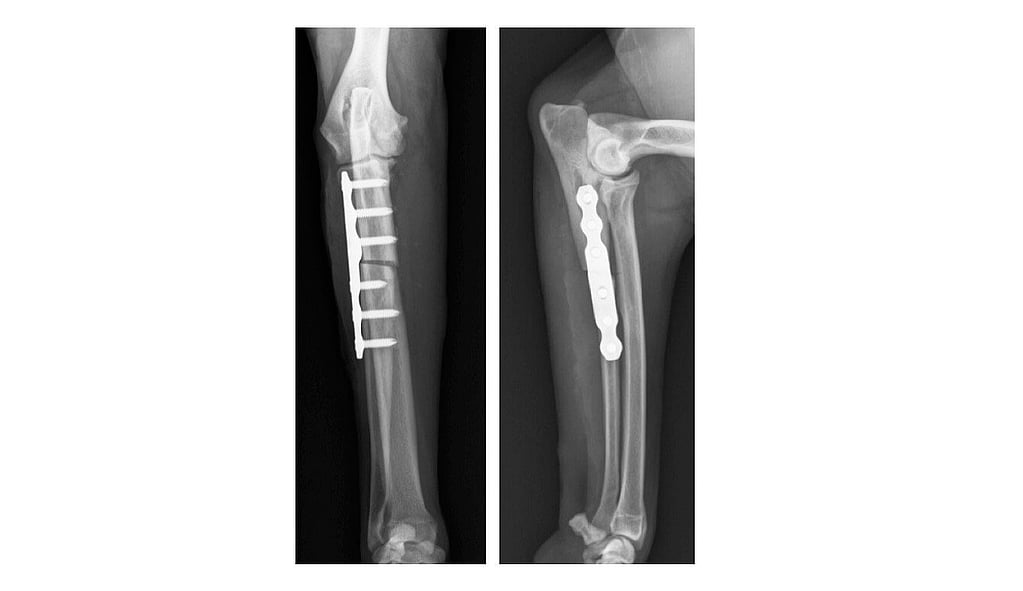 Röntgenfoto van een gebroken been.