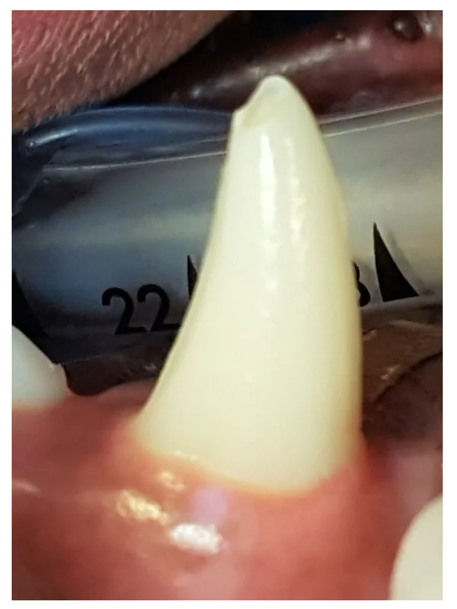 Een close-up van een tand.