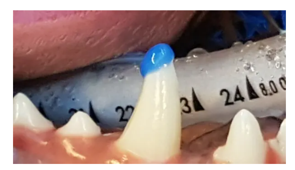 Een close-up van tanden.