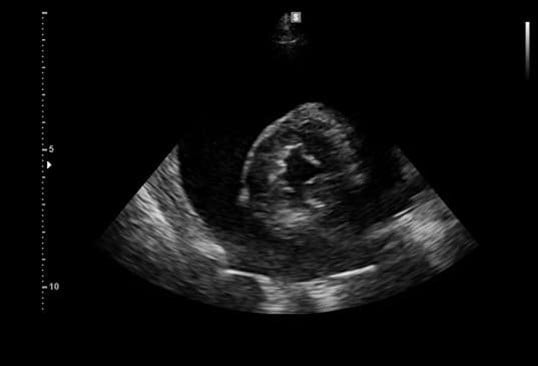 Een echo van een baby.