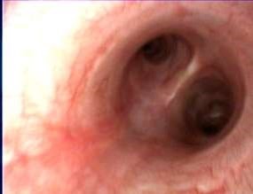 Close-up van een oor.