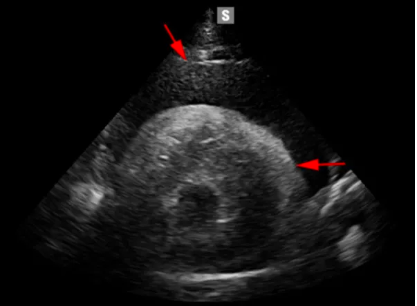 Een echografie van een foetus.